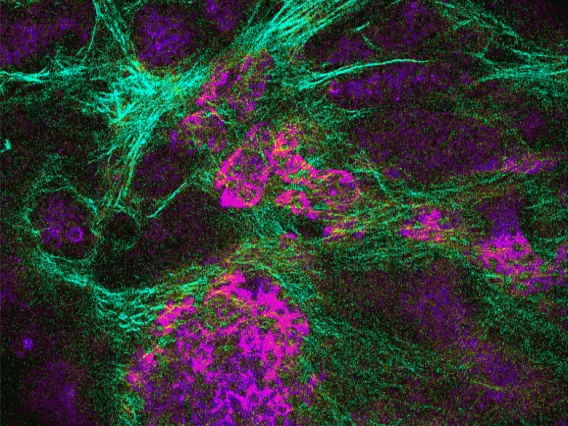Image of Cancer Cells