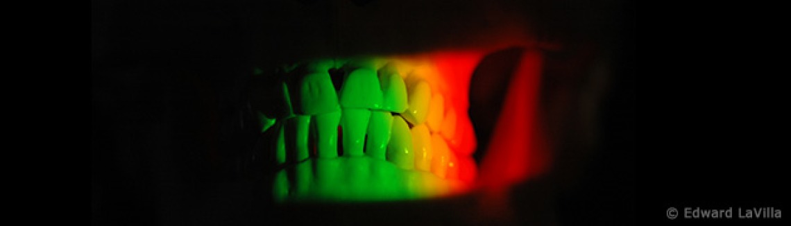 image reconstruction of teeth